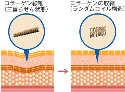 即効性の引き締め効果