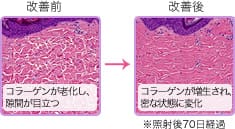 持続性の効果